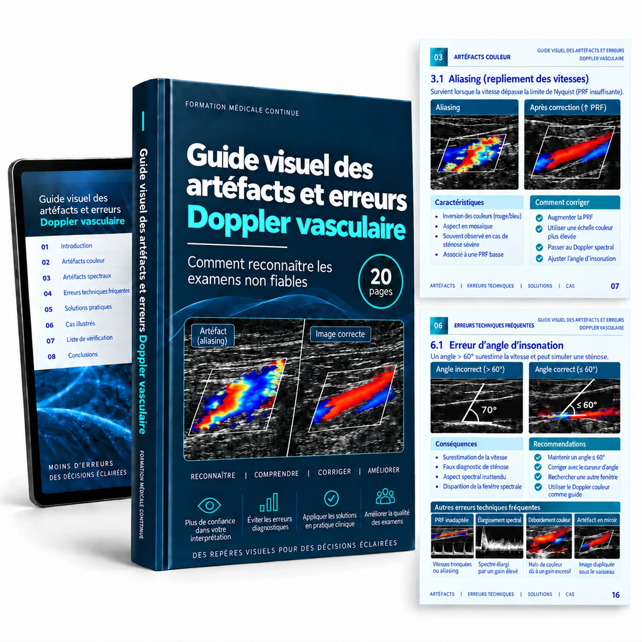 Guide visuel des artefacts et des erreurs