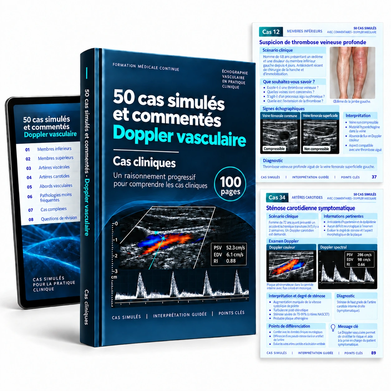 Présentation du support numérique : 50 cas simulés et commentés — Doppler vasculaire