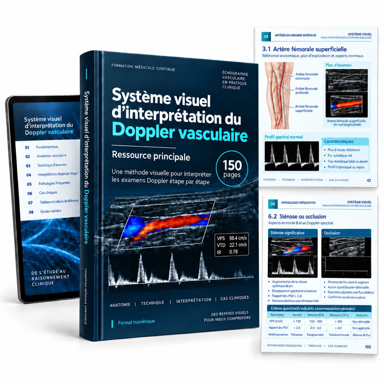 Présentation du support numérique : Système visuel d’interprétation du Doppler vasculaire
