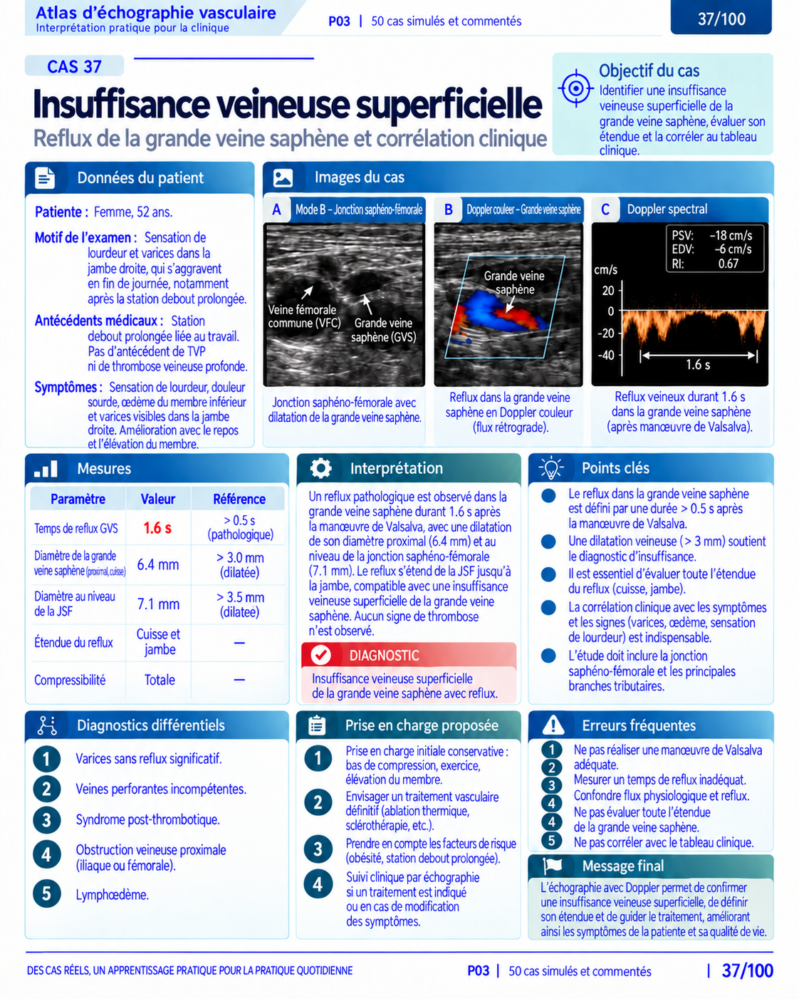 Page 37 : Cas : insuffisance veineuse superficielle. Aperçu de présentation en français du support numérique de Doppler vasculaire.