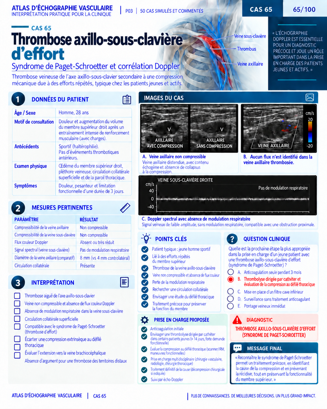 Page 65 : Cas : thrombose axillo-sous-clavière. Aperçu de présentation en français du support numérique de Doppler vasculaire.