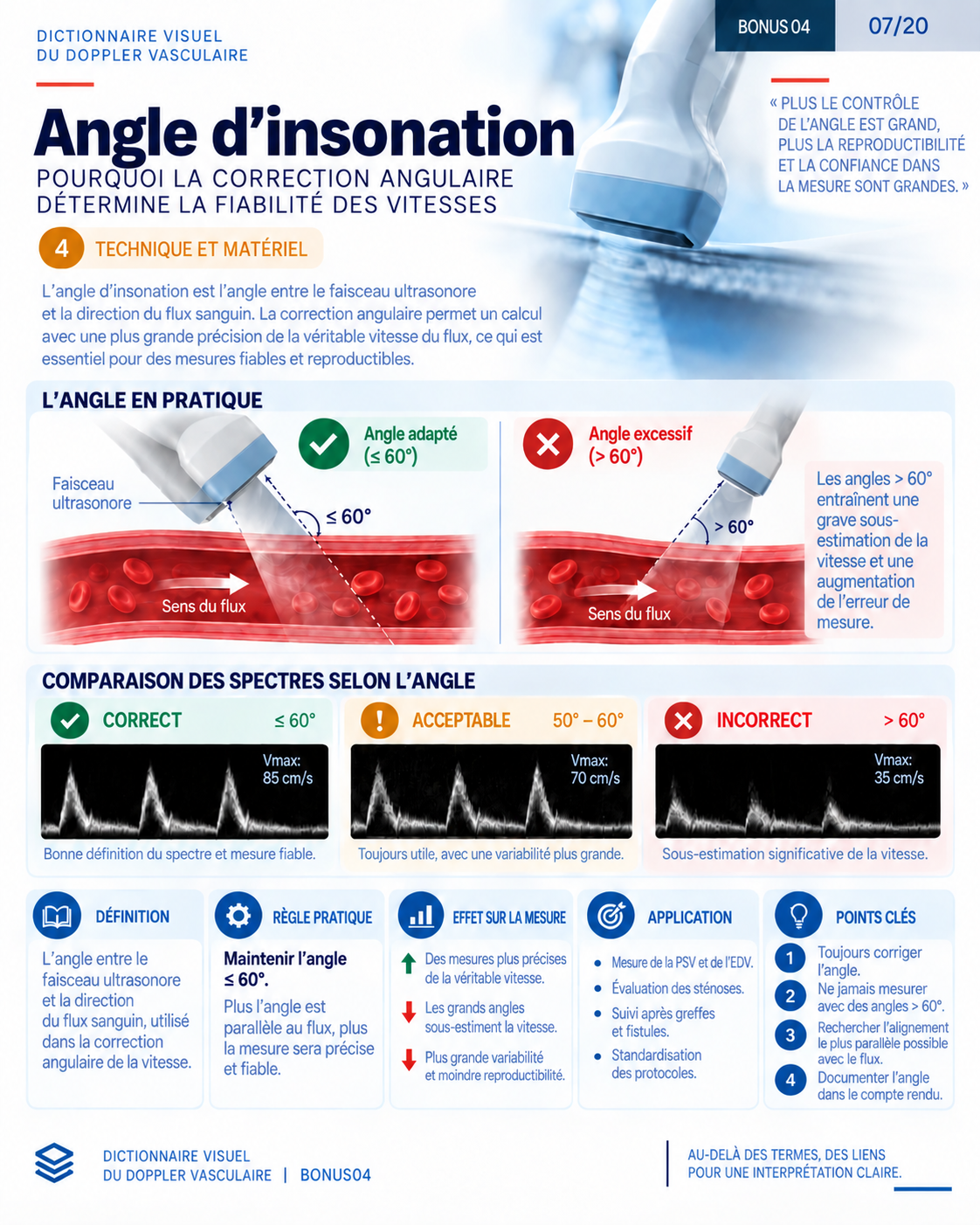 Page 7 : Angle d’insonation. Aperçu de présentation en français du support numérique de Doppler vasculaire.