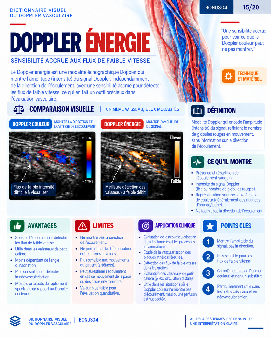 Page 15 : Doppler énergie. Aperçu de présentation en français du support numérique de Doppler vasculaire.
