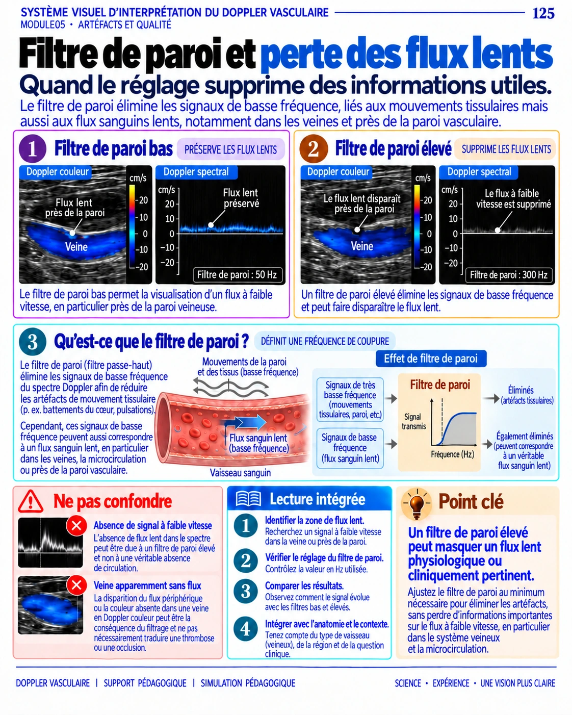 Page 125 : Filtre de paroi et flux lent. Aperçu de présentation en français du support numérique de Doppler vasculaire.